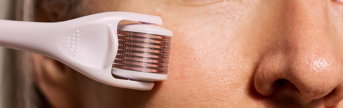 Does Microneedling at Home Really Work?